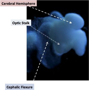 Ohio State's lab-grown brain