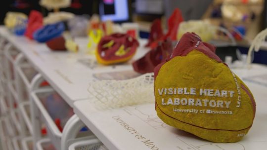 A 3D printed heart from the University of Minnesota's Visible Heart Lab