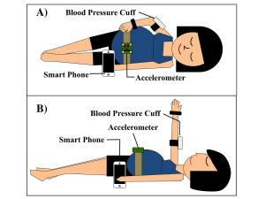 Diagram of how the Purdue UNiversity device and app for detecting preeclampsia works with a blood pressure cuff