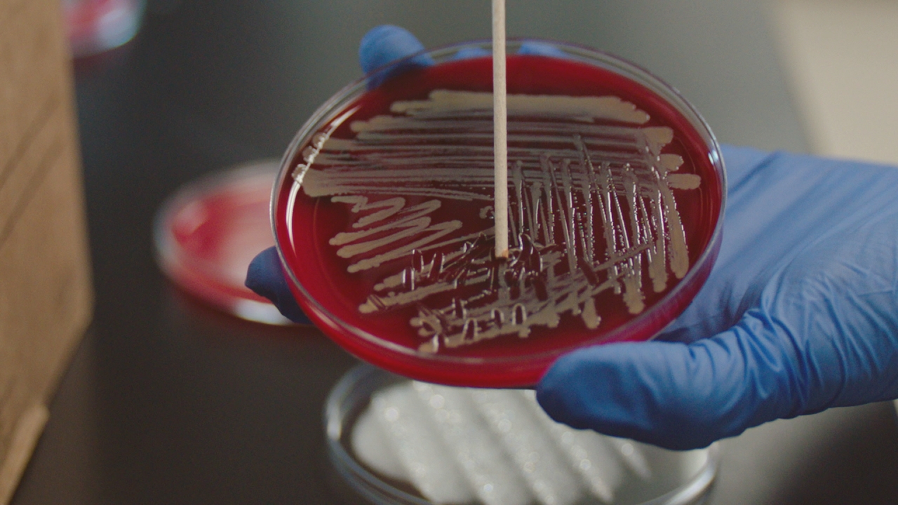 Northwestern confronts the global challenge of antibiotic-resistant
microbes: BTN LiveBIG